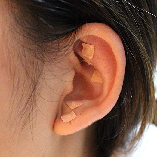 Do Ear Magnets for Weight Loss Really Work?